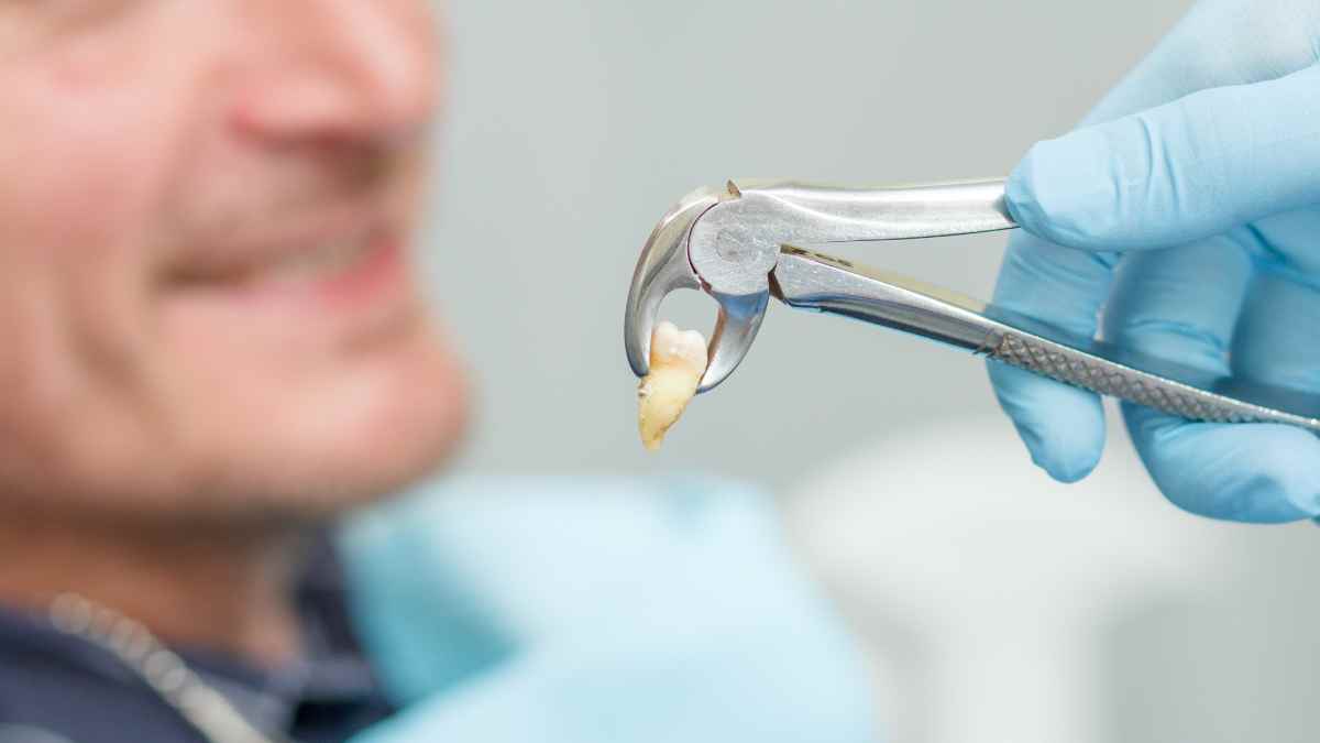 A Man's tooth being extracted